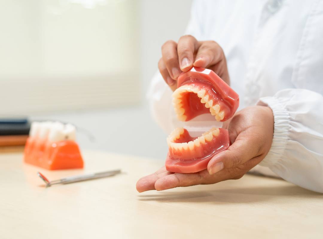 Rehabilitación oral